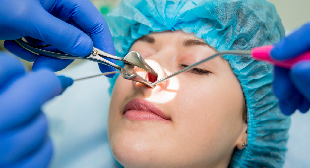 Resección de tumores nasales en CDMX y Edo. Mex. - Especialidad en Otorrinolaringología y Cirugía de Cabeza y Cuello